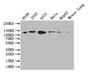 Western Blot; Positive WB detected in: A549 whole cell lysate, SY5Y whole cell lysate, A375 whole cell lysate, HEPG2 whole cell lysate, Mouse Lung tissue lysate; All lanes: DDR2 antibody at 1:1000; Secondary; Goat polyclonal to rabbit IgG at 1/50000 dilution; Predicted band size: 96 kDa; Observed band size: 110 kDa