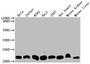 Western Blot; Positive WB detected in: Hela whole cell lysate, Jurkat whole cell lysate, K562 whole cell lysate, Raji whole cell lysate, 293T whole cell lysate, Rat heart tissue, Mouse kidney tissue, Mouse liver tissue; All lanes: DHFR antibody at 1:2000; Secondary; Goat polyclonal to rabbit IgG at 1/50000 dilution; Predicted band size: 22, 16 kDa; Observed band size: 22 kDa