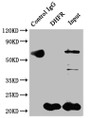 Immunoprecipitating DHFR in Hela whole cell lysate; Lane 1: Rabbit control IgG instead of CAC12133 in Hela whole cell lysate.For western blotting,a HRP-conjugated Protein G antibody was used as the secondary antibody (1/2000); Lane 2: CAC12133(2ug)+ Hela whole cell lysate(500ug); Lane 3: Hela whole cell lysate (10ug)