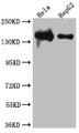 Western Blot; Positive WB detected in: Hela whole cell lysate, HepG2 whole cell lysate; All lanes: DNA Ligase I antibody at 1:1000; Secondary; Goat polyclonal to rabbit IgG at 1/50000 dilution; Predicted band size: 102, 89, 99 kDa; Observed band size: 140 kDa