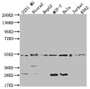 Western Blot; Positive WB detected in: U251 whole cell lysate, Ntera-2 whole cell lysate, HepG2 whole cell lysate, MCF-7 whole cell lysate, Hela whole cell lysate, Jurkat whole cell lysate, K562 whole cell lysate; All lanes: DNAJA1 antibody at 1:2000; Secondary; Goat polyclonal to rabbit IgG at 1/50000 dilution; Predicted band size: 45, 38 kDa; Observed band size: 45-55 kDa