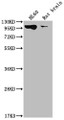 Western Blot; Positive WB detected in: HL60 whole cell lysate, Rat brain tissue; All lanes: DNM2 antibody at 1:2000; Secondary; Goat polyclonal to rabbit IgG at 1/50000 dilution; Predicted band size: 99, 98 kDa; Observed band size: 99 kDa