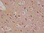 IHC image of CAC12144 diluted at 1:100 and staining in paraffin-embedded human brain tissue performed on a Leica BondTM system. After dewaxing and hydration, antigen retrieval was mediated by high pressure in a citrate buffer (pH 6.0). Section was blocked with 10% normal goat serum 30min at RT. Then primary antibody (1% BSA) was incubated at 4°C overnight. The primary is detected by a Goat anti-rabbit polymer IgG labeled by HRP and visualized using 0.05% DAB.