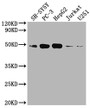 Western Blot; Positive WB detected in: SH-SY5Y whole cell lysate, PC3 whole cell lysate, HepG2 whole cell lysate, Jurkat whole cell lysate, U251 whole cell lysate; All lanes: EDG1 antibody at 1:2000; Secondary; Goat polyclonal to rabbit IgG at 1/50000 dilution; Predicted band size: 43 kDa; Observed band size: 43 kDa