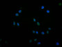 Immunofluorescence staining of MCF7 with CAC12158 at 1:25, counter-stained with DAPI. The cells were fixed in 4% formaldehyde and blocked in 10% normal Goat Serum. The cells were then incubated with the antibody overnight at 4°C. The secondary antibody was Alexa Fluor 499-congugated AffiniPure Goat Anti-Rabbit IgG(H+L).