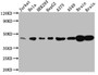 Western Blot; Positive WB detected in: Jurkat whole cell lysate, Hela whole cell lysate, HEK293 whole cell lysate, HepG2 whole cell lysate, A375 whole cell lysate, A549 whole cell lysate, Rat Brain whole cell lysate, Mouse Brain whole cell lysate; All lanes: ERK2 antibody at 1:1000; Secondary; Goat polyclonal to rabbit IgG at 1/50000 dilution; Predicted band size: 42, 37 kDa; Observed band size: 42 kDa