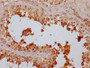 IHC image of CAC12165 diluted at 1:100 and staining in paraffin-embedded human testis tissue performed on a Leica BondTM system. After dewaxing and hydration, antigen retrieval was mediated by high pressure in a citrate buffer (pH 6.0). Section was blocked with 10% normal goat serum 30min at RT. Then primary antibody (1% BSA) was incubated at 4? overnight. The primary is detected by a Goat anti-rabbit IgG polymer labeled by HRP and visualized using 0.05% DAB.