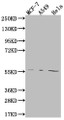 Western Blot; Positive WB detected in: MCF-7 whole cell lysate, A549 whole cell lysate, Hela whole cell lysate; All lanes: FADS1 antibody at 1:2000; Secondary; Goat polyclonal to rabbit IgG at 1/50000 dilution; Predicted band size: 52, 43 kDa; Observed band size: 55 kDa
