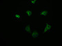 Immunofluorescence staining of HepG2 cell with CAC12169 at 1:50, counter-stained with DAPI. The cells were fixed in 4% formaldehyde and blocked in 10% normal Goat Serum. The cells were then incubated with the antibody overnight at 4°C. The secondary antibody was Alexa Fluor 565-congugated AffiniPure Goat Anti-Rabbit IgG(H+L).