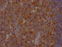 IHC image of CAC12171 diluted at 1:100 and staining in paraffin-embedded human tonsil tissue performed on a Leica BondTM system. After dewaxing and hydration, antigen retrieval was mediated by high pressure in a citrate buffer (pH 6.0). Section was blocked with 10% normal goat serum 30min at RT. Then primary antibody (1% BSA) was incubated at 4? overnight. The primary is detected by a Goat anti-rabbit IgG polymer labeled by HRP and visualized using 0.05% DAB.