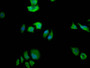 Immunofluorescence staining of Hela Cells with CAC12172 at 1:50, counter-stained with DAPI. The cells were fixed in 4% formaldehyde, permeated by 0.2% TritonX-100, and blocked in 10% normal Goat Serum. The cells were then incubated with the antibody overnight at 4?. Nuclear DNA was labeled in blue with DAPI. The secondary antibody was FITC-conjugated AffiniPure Goat Anti-Rabbit IgG (H+L).