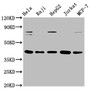 Western Blot; Positive WB detected in: Hela whole cell lysate, Raji whole cell lysate, HepG2 whole cell lysate, Jurkat whole cell lysate, MCF-7 whole cell lysate; All lanes: FEN1 antibody at 0.775ug/ml; Secondary; Goat polyclonal to rabbit IgG at 1/50000 dilution; Predicted band size: 43, 36 KDa; Observed band size: 43 KDa