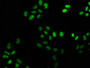 Immunofluorescence staining of Hela cells with CAC12176 at 1:25, counter-stained with DAPI. The cells were fixed in 4% formaldehyde, permeabilized using 0.2% Triton X-100 and blocked in 10% normal Goat Serum. The cells were then incubated with the antibody overnight at 4?. The secondary antibody was Alexa Fluor 488-congugated AffiniPure Goat Anti-Rabbit IgG (H+L).