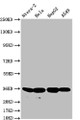 Western Blot; Positive WB detected in: Ntera-2 whole cell lysate, Hela whole cell lysate, HepG2 whole cell lysate, A549 whole cell lysate; All lanes: FGF19 antibody at 1:500; Secondary; Goat polyclonal to rabbit IgG at 1/50000 dilution; Predicted band size: 25 kDa; Observed band size: 36 kDa