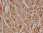 IHC image of CAC12184 diluted at 1:100 and staining in paraffin-embedded human heart tissue performed on a Leica BondTM system. After dewaxing and hydration, antigen retrieval was mediated by high pressure in a citrate buffer (pH 6.0). Section was blocked with 10% normal goat serum 30min at RT. Then primary antibody (1% BSA) was incubated at 4°C overnight. The primary is detected by a Goat anti-rabbit polymer IgG labeled by HRP and visualized using 0.05% DAB.