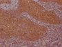 IHC image of CAC12187 diluted at 1:100 and staining in paraffin-embedded human tonsil tissue performed on a Leica BondTM system. After dewaxing and hydration, antigen retrieval was mediated by high pressure in a citrate buffer (pH 6.0). Section was blocked with 10% normal goat serum 30min at RT. Then primary antibody (1% BSA) was incubated at 4? overnight. The primary is detected by a Goat anti-rabbit IgG polymer labeled by HRP and visualized using 0.05% DAB.