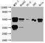 Western Blot; Positive WB detected in: MCF-7 whole cell lysate, HepG2 whole cell lysate, PC-3 whole cell lysate, 293 whole cell lysate, Hela whole cell lysate; All lanes: FOXA1 antibody at 1:2000; Secondary; Goat polyclonal to rabbit IgG at 1/50000 dilution; Predicted band size: 50, 46 kDa; Observed band size: 50 kDa
