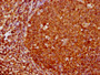 IHC image of CAC12189 diluted at 1:180 and staining in paraffin-embedded human tonsil tissue performed on a Leica BondTM system. After dewaxing and hydration, antigen retrieval was mediated by high pressure in a citrate buffer (pH 6.0). Section was blocked with 10% normal goat serum 30min at RT. Then primary antibody (1% BSA) was incubated at 4? overnight. The primary is detected by a biotinylated secondary antibody and visualized using an HRP conjugated SP system.