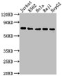 Western Blot; Positive WB detected in: Jurkat whole cell lysate, K562 whole cell lysate, Hela whole cell lysate, Raji whole cell lysate, HepG2 whole cell lysate; All lanes: FUBP1 antibody at 1:2000; Secondary; Goat polyclonal to rabbit IgG at 1/50000 dilution; Predicted band size: 68, 69 kDa; Observed band size: 69 kDa