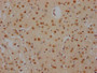 IHC image of CAC12194 diluted at 1:100 and staining in paraffin-embedded human brain tissue performed on a Leica BondTM system. After dewaxing and hydration, antigen retrieval was mediated by high pressure in a citrate buffer (pH 6.0). Section was blocked with 10% normal goat serum 30min at RT. Then primary antibody (1% BSA) was incubated at 4? overnight. The primary is detected by a Goat anti-rabbit IgG polymer labeled by HRP and visualized using 0.05% DAB.