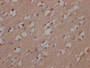 IHC image of CAC12196 diluted at 1:100 and staining in paraffin-embedded human brain tissue performed on a Leica BondTM system. After dewaxing and hydration, antigen retrieval was mediated by high pressure in a citrate buffer (pH 6.0). Section was blocked with 10% normal goat serum 30min at RT. Then primary antibody (1% BSA) was incubated at 4? overnight. The primary is detected by a Goat anti-rabbit IgG polymer labeled by HRP and visualized using 0.05% DAB.