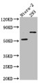 Western Blot; Positive WB detected in: Ntera-2 whole cell lysate, HEK293 whole cell lysate; All lanes: GABA A Receptor alpha 5 antibody at 1:1000; Secondary; Goat polyclonal to rabbit IgG at 1/50000 dilution; Predicted band size: 53 kDa; Observed band size: 70 kDa