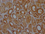 IHC image of CAC12212 diluted at 1:100 and staining in paraffin-embedded human kidney tissue performed on a Leica BondTM system. After dewaxing and hydration, antigen retrieval was mediated by high pressure in a citrate buffer (pH 6.0). Section was blocked with 10% normal goat serum 30min at RT. Then primary antibody (1% BSA) was incubated at 4? overnight. The primary is detected by a Goat anti-rabbit IgG polymer labeled by HRP and visualized using 0.05% DAB.