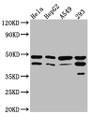 Western Blot; Positive WB detected in: Hela whole cell lysate, HepG2 whole cell lysate, A549 whole cell lysate, 293 whole cell lysate; All lanes: GSK3 beta Antibody at 1:1000; Secondary; Goat polyclonal to rabbit IgG at 1/50000 dilution; Predicted band size: 47, 49 kDa; Observed band size: 47 kDa