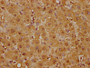 IHC image of CAC12225 diluted at 1:125 and staining in paraffin-embedded human liver tissue performed on a Leica BondTM system. After dewaxing and hydration, antigen retrieval was mediated by high pressure in a citrate buffer (pH 6.0). Section was blocked with 10% normal goat serum 30min at RT. Then primary antibody (1% BSA) was incubated at 4? overnight. The primary is detected by a biotinylated secondary antibody and visualized using an HRP conjugated SP system.