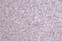 IHC image of CAC12227 diluted at 1:50 and staining in paraffin-embedded human pancreati tissue performed on a Leica BondTM system. After dewaxing and hydration, antigen retrieval was mediated by high pressure in a citrate buffer (pH 6.0). Section was blocked with 10% normal goat serum 30min at RT. Then primary antibody (1% BSA) was incubated at 4°C overnight. The primary is detected by a Goat anti-rabbit polymer IgG labeled by HRP and visualized using 0.27% DAB.