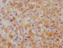 IHC image of CAC12228 diluted at 1:215 and staining in paraffin-embedded human liver tissue performed on a Leica BondTM system. After dewaxing and hydration, antigen retrieval was mediated by high pressure in a citrate buffer (pH 6.0). Section was blocked with 10% normal goat serum 30min at RT. Then primary antibody (1% BSA) was incubated at 4? overnight. The primary is detected by a biotinylated secondary antibody and visualized using an HRP conjugated SP system.