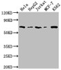 Western Blot; Positive WB detected in: Hela whole cell lysate, HepG2 whole cell lysate, Jurkat whole cell lysate, MCF-7 whole cell lysate, K562 whole cell lysate; All lanes: HDAC2 antibody at 1:2000; Secondary; Goat polyclonal to rabbit IgG at 1/50000 dilution; Predicted band size: 56, 52 kDa; Observed band size: 60 kDa