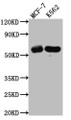 Western Blot; Positive WB detected in: MCF-7 whole cell lysate, K562 whole cell lysate; All lanes: HDAC2 antibody at 1:1000; Secondary; Goat polyclonal to rabbit IgG at 1/50000 dilution; Predicted band size: 56, 52 kDa; Observed band size: 60 kDa