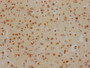 IHC image of CAC12232 diluted at 1:100 and staining in paraffin-embedded human brain tissue performed on a Leica BondTM system. After dewaxing and hydration, antigen retrieval was mediated by high pressure in a citrate buffer (pH 6.0). Section was blocked with 10% normal goat serum 30min at RT. Then primary antibody (1% BSA) was incubated at 4? overnight. The primary is detected by a Goat anti-rabbit IgG polymer labeled by HRP and visualized using 0.05% DAB.