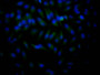 Immunofluorescence staining of Hela Cells with CAC12232 at 1:50, counter-stained with DAPI. The cells were fixed in 4% formaldehyde, permeated by 0.2% TritonX-100, and blocked in 10% normal Goat Serum. The cells were then incubated with the antibody overnight at 4?. Nuclear DNA was labeled in blue with DAPI. The secondary antibody was FITC-conjugated AffiniPure Goat Anti-Rabbit IgG (H+L).