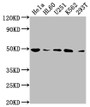 Western Blot; Positive WB detected in: Hela whole cell lysate, HL60 whole cell lysate, U251 whole cell lysate, K562 whole cell lysate, 293T whole cell lysate; All lanes: HDAC3 antibody at 1:2000; Secondary; Goat polyclonal to rabbit IgG at 1/50000 dilution; Predicted band size: 49, 50 kDa; Observed band size: 49 kDa