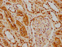 IHC image of CAC12235 diluted at 1:154 and staining in paraffin-embedded human kidney tissue performed on a Leica BondTM system. After dewaxing and hydration, antigen retrieval was mediated by high pressure in a citrate buffer (pH 6.0). Section was blocked with 10% normal goat serum 30min at RT. Then primary antibody (1% BSA) was incubated at 4? overnight. The primary is detected by a biotinylated secondary antibody and visualized using an HRP conjugated SP system.