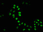 Immunofluorescence staining of Hela cells with CAC12235 at 1:51, counter-stained with DAPI. The cells were fixed in 4% formaldehyde, permeabilized using 0.2% Triton X-100 and blocked in 10% normal Goat Serum. The cells were then incubated with the antibody overnight at 4?. The secondary antibody was Alexa Fluor 488-congugated AffiniPure Goat Anti-Rabbit IgG (H+L).