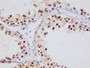 IHC image of CAC12238 diluted at 1:100 and staining in paraffin-embedded human testis tissue performed on a Leica BondTM system. After dewaxing and hydration, antigen retrieval was mediated by high pressure in a citrate buffer (pH 6.0). Section was blocked with 10% normal goat serum 30min at RT. Then primary antibody (1% BSA) was incubated at 4°C overnight. The primary is detected by a Goat anti-rabbit polymer IgG labeled by HRP and visualized using 0.05% DAB.