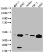 Western Blot; Positive WB detected in: MCF-7 whole cell lysate, K562 whole cell lysate, Jurkat whole cell lysate, THP-1 whole cell lysate, U937 whole cell lysate; All lanes: HMBS antibody at 1:2000; Secondary; Goat polyclonal to rabbit IgG at 1/50000 dilution; Predicted band size: 40, 38, 35, 34kDa; Observed band size: 36-55 kDa
