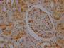 IHC image of CAC12251 diluted at 1:100 and staining in paraffin-embedded human kidney tissue performed on a Leica BondTM system. After dewaxing and hydration, antigen retrieval was mediated by high pressure in a citrate buffer (pH 6.0). Section was blocked with 10% normal goat serum 30min at RT. Then primary antibody (1% BSA) was incubated at 4? overnight. The primary is detected by a Goat anti-rabbit IgG polymer labeled by HRP and visualized using 0.05% DAB.