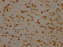 IHC image of CAC12251 diluted at 1:100 and staining in paraffin-embedded human brain tissue performed on a Leica BondTM system. After dewaxing and hydration, antigen retrieval was mediated by high pressure in a citrate buffer (pH 6.0). Section was blocked with 10% normal goat serum 30min at RT. Then primary antibody (1% BSA) was incubated at 4? overnight. The primary is detected by a Goat anti-rabbit IgG polymer labeled by HRP and visualized using 0.05% DAB.