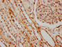 IHC image of CAC12252 diluted at 1:66.35 and staining in paraffin-embedded human kidney tissue performed on a Leica BondTM system. After dewaxing and hydration, antigen retrieval was mediated by high pressure in a citrate buffer (pH 6.0). Section was blocked with 10% normal goat serum 30min at RT. Then primary antibody (1% BSA) was incubated at 4? overnight. The primary is detected by a biotinylated secondary antibody and visualized using an HRP conjugated SP system.