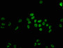 Immunofluorescence staining of Hela cells with CAC12252 at 1:22, counter-stained with DAPI. The cells were fixed in 4% formaldehyde, permeabilized using 0.2% Triton X-100 and blocked in 10% normal Goat Serum. The cells were then incubated with the antibody overnight at 4?. The secondary antibody was Alexa Fluor 488-congugated AffiniPure Goat Anti-Rabbit IgG (H+L).
