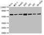 Western Blot; Positive WB detected in: Hela whole cell lysate, MCF-7 whole cell lysate, HepG2 whole cell lysate, 293T whole cell lysate, 293 whole cell lysate, U87 whole cell lysate, SH-SY5Y whole cell lysate; All lanes: HNRNPK antibody at 1.3ug/ml; Secondary; Goat polyclonal to rabbit IgG at 1/50000 dilution; Predicted band size: 51, 52, 49 KDa; Observed band size: 60 KDa