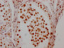 IHC image of CAC12256 diluted at 1:100 and staining in paraffin-embedded human testis tissue performed on a Leica BondTM system. After dewaxing and hydration, antigen retrieval was mediated by high pressure in a citrate buffer (pH 6.0). Section was blocked with 10% normal goat serum 30min at RT. Then primary antibody (1% BSA) was incubated at 4? overnight. The primary is detected by a Goat anti-rabbit IgG polymer labeled by HRP and visualized using 0.05% DAB.