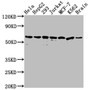 Western Blot; Positive WB detected in: Hela whole cell lysate, HepG2 whole cell lysate, 293 whole cell lysate, Jurkat whole cell lysate, MCF-7 whole cell lysate, K562 whole cell lysate, Mouse brain tissue; All lanes: HSPD1 antibody at 1:2000; Secondary; Goat polyclonal to rabbit IgG at 1/50000 dilution; Predicted band size: 62, 18 kDa; Observed band size: 60 kDa