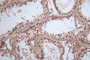 IHC image of CAC12262 diluted at 1:100 and staining in paraffin-embedded human testis tissue performed on a Leica BondTM system. After dewaxing and hydration, antigen retrieval was mediated by high pressure in a citrate buffer (pH 6.0). Section was blocked with 10% normal goat serum 30min at RT. Then primary antibody (1% BSA) was incubated at 4°C overnight. The primary is detected by a Goat anti-rabbit polymer IgG labeled by HRP and visualized using 0.05% DAB.