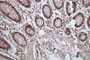 IHC image of CAC12262 diluted at 1:100 and staining in paraffin-embedded human colon tissue performed on a Leica BondTM system. After dewaxing and hydration, antigen retrieval was mediated by high pressure in a citrate buffer (pH 6.0). Section was blocked with 10% normal goat serum 30min at RT. Then primary antibody (1% BSA) was incubated at 4°C overnight. The primary is detected by a Goat anti-rabbit polymer IgG labeled by HRP and visualized using 0.05% DAB.