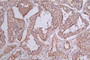 IHC image of CAC12263 diluted at 1:50 and staining in paraffin-embedded human testis tissue performed on a Leica BondTM system. After dewaxing and hydration, antigen retrieval was mediated by high pressure in a citrate buffer (pH 6.0). Section was blocked with 10% normal goat serum 30min at RT. Then primary antibody (1% BSA) was incubated at 4°C overnight. The primary is detected by a Goat anti-rabbit polymer IgG labeled by HRP and visualized using 0.74% DAB.